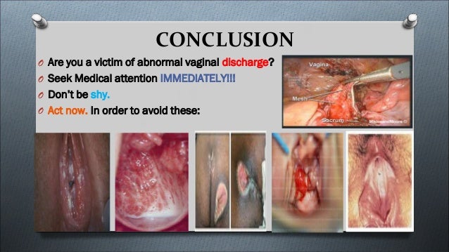 vaginal secretions photos Mummy suck my tits